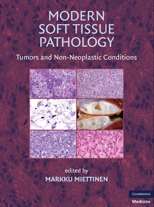 Modern Soft Tissue Pathology