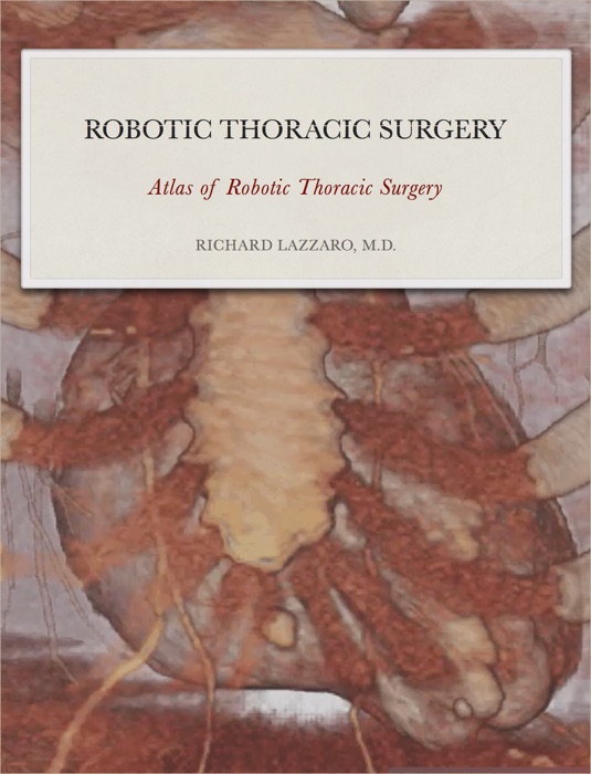 Robotic Pulmonary Resection