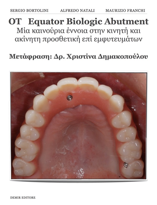 OT   Equator Biologic Abutment Μία καινούρια έννοια στην κινητή και ακίνητη προσθετική επί εμφυτευμάτων