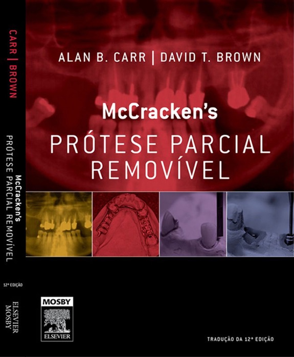 McCracken’s prótese parcial removível: Tradução da 12ª edição