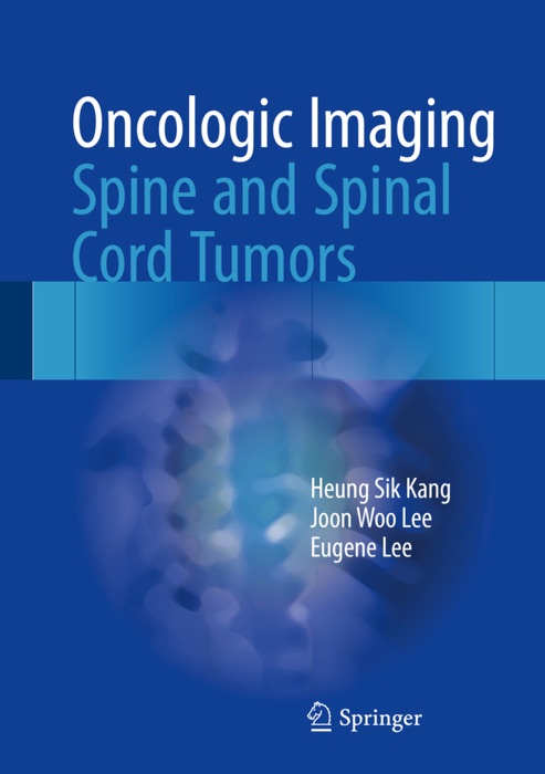 Oncologic Imaging: Spine and Spinal Cord Tumors