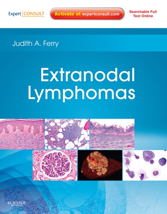 Extranodal Lymphomas E-Book