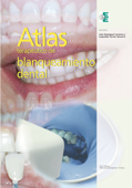 Atlas terapéutico de blanqueamiento dental - José Amengual Lorenzo & Eee Labor Dental