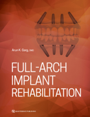 Full-Arch Implant Rehabilitation - Arun Garg