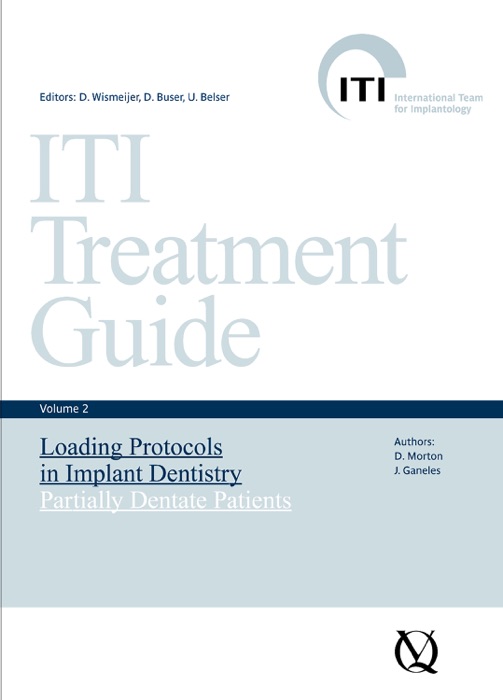 Loading Protocols in Implant Dentistry