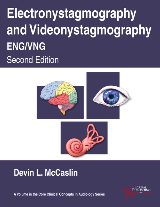 Electronystagmography and Videonystagmography (ENG/VNG), Second Edition