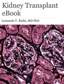 Kidney Transplant eBook - Leonardo V. Riella