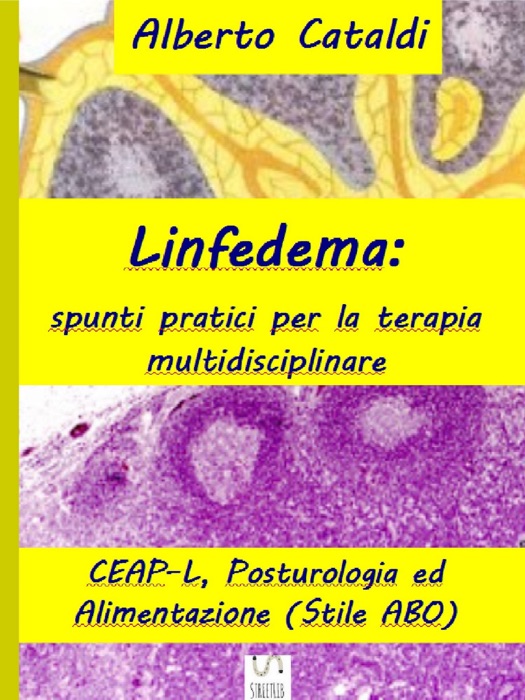 Linfedema