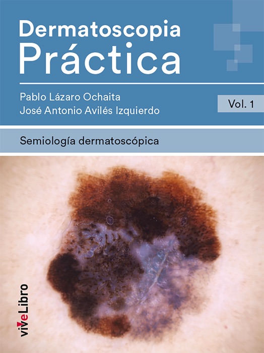 Dermatoscopia Práctica. Vol. 1: Semiología Dermatoscópica