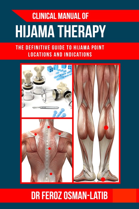 Clinical Manual of Hijama Therapy