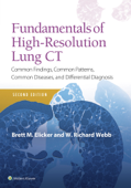 Fundamentals of High-Resolution Lung CT - Brett M. Elicker & W. Richard Webb