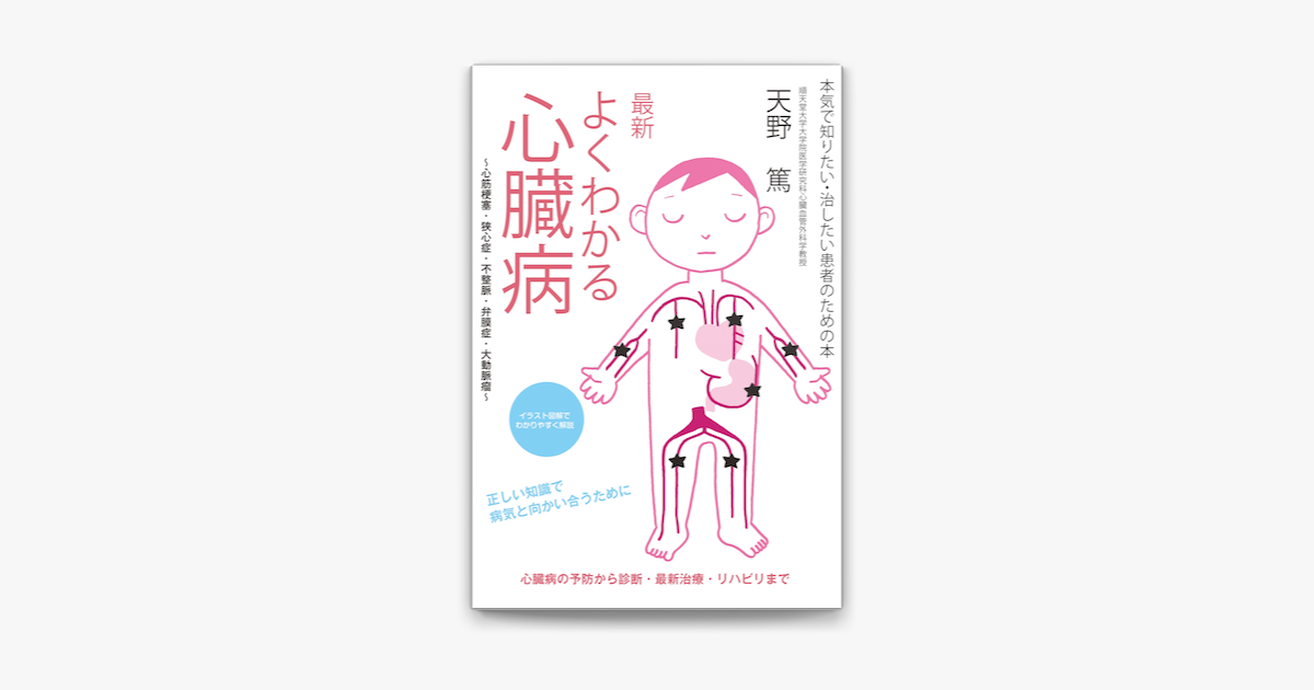 最新 よくわかる心臓病 心筋梗塞 狭心症 不整脈 弁膜症 大動脈瘤 On Apple Books