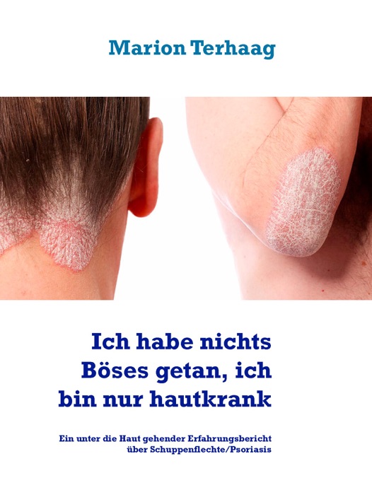 Ich habe nichts Böses getan, ich bin nur hautkrank