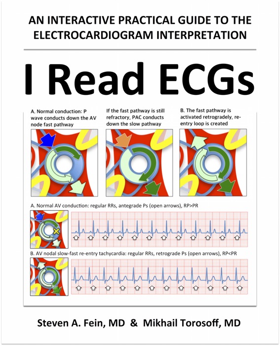 I Read ECGs