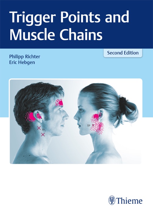 Trigger Points and Muscle Chains