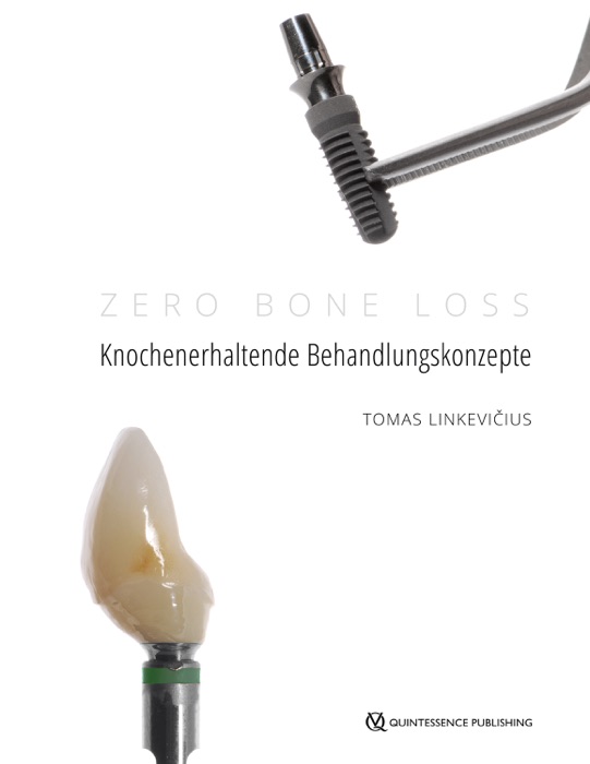 Zero Bone Loss: Knochenerhaltende Behandlungskonzepte