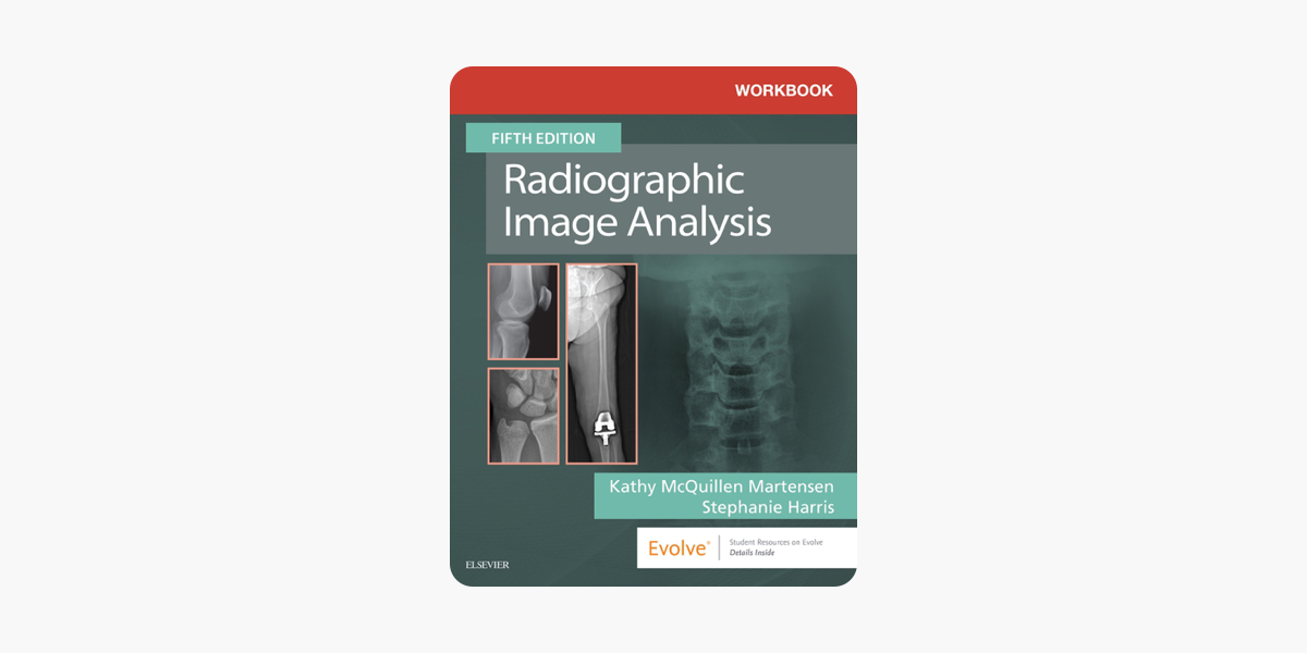 Read E Book Workbook For Radiographic Image Analysis E Book - 