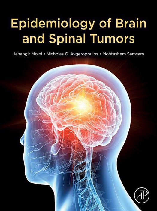 Epidemiology of Brain and Spinal Tumors (Enhanced Edition)