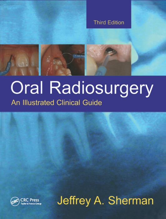 Oral Radiosurgery