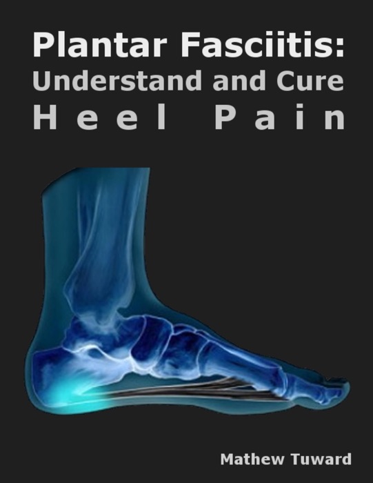 Plantar Fasciitis: Understand and Cure Heel Pain