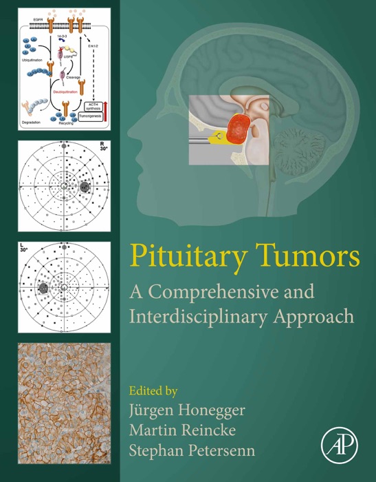 Pituitary Tumors (Enhanced Edition)