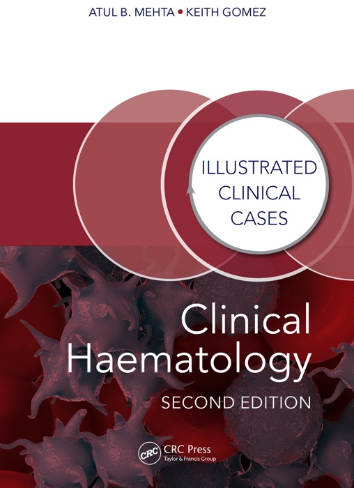 Clinical Haematology