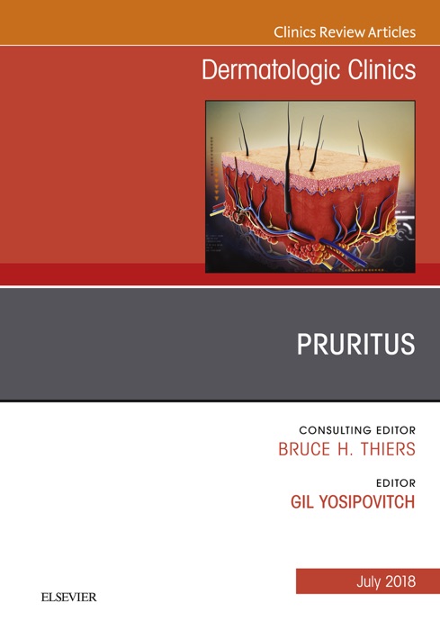 Pruritus, An Issue of Dermatologic Clinics, E-Book