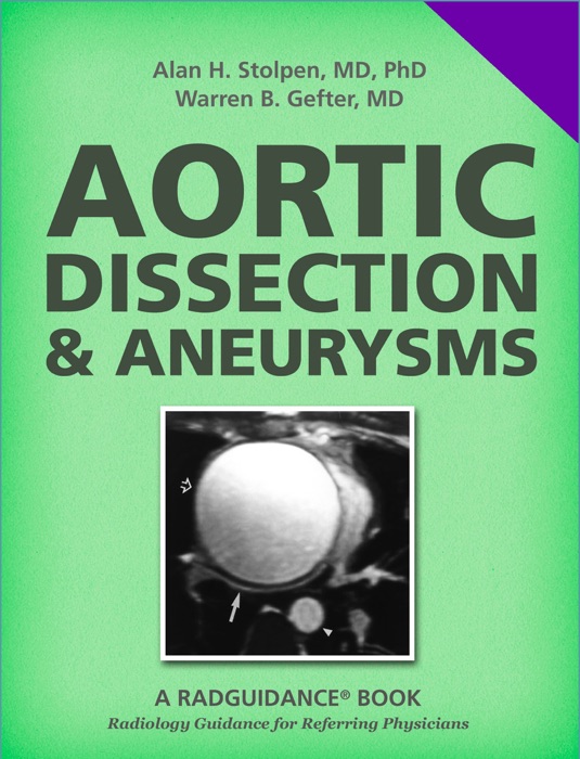 Aortic Dissection and Aneurysms