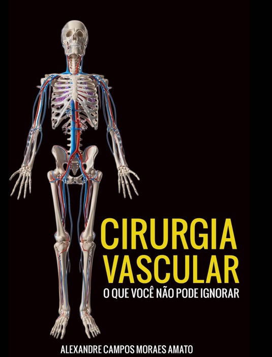 Cirurgia vascular