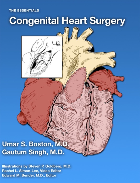 Congenital Heart Surgery