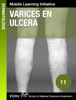 Varices en ulcera - Annemiek Silven, Amber Hof, Yoony Gent & Marjolein Wintzen