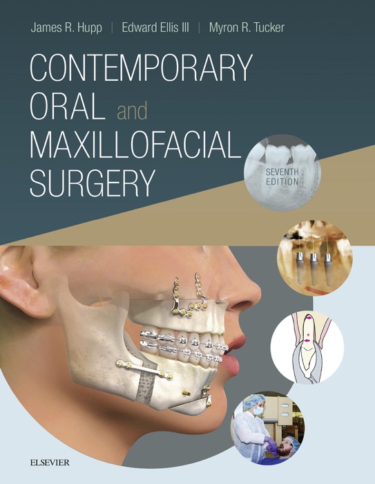 Contemporary Oral and Maxillofacial Surgery E-Book