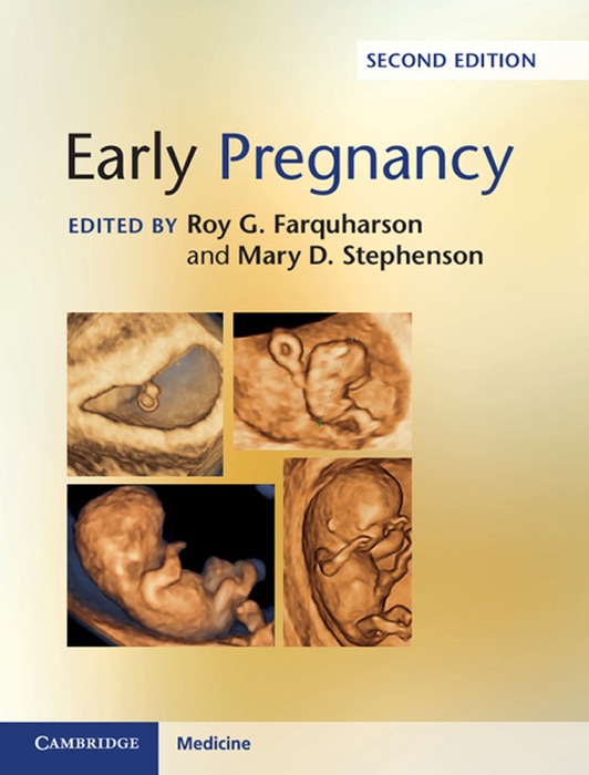 Early Pregnancy: Second Edition