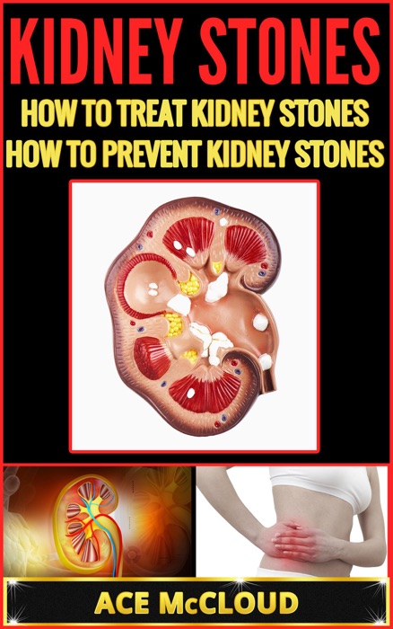 Kidney Stones: How To Treat Kidney Stones: How To Prevent Kidney Stones