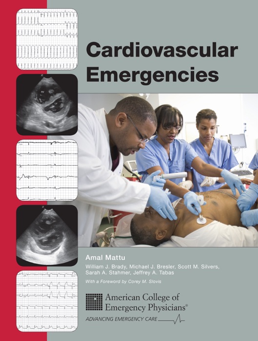 Cardiovascular Emergencies