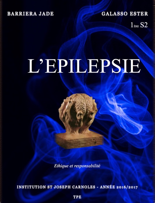 L’épilepsie