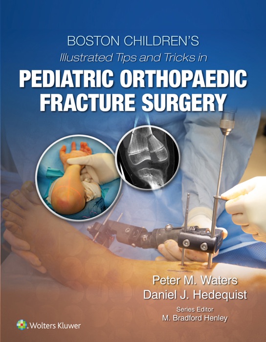 Boston Children’s Illustrated Tips and Tricks in Pediatric Orthopaedic Fracture Surgery