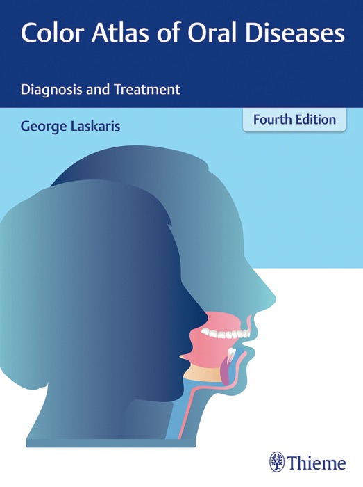 Color Atlas of Oral Diseases