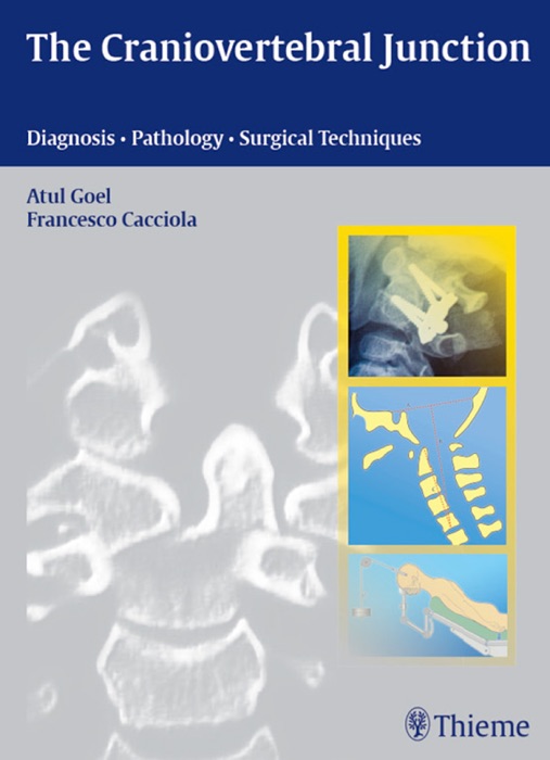 Craniovertebral Junction