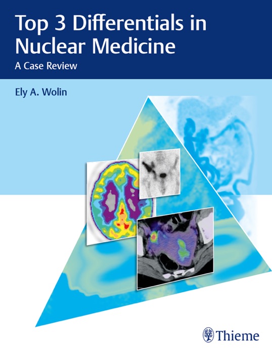 Top 3 Differentials in Nuclear Medicine