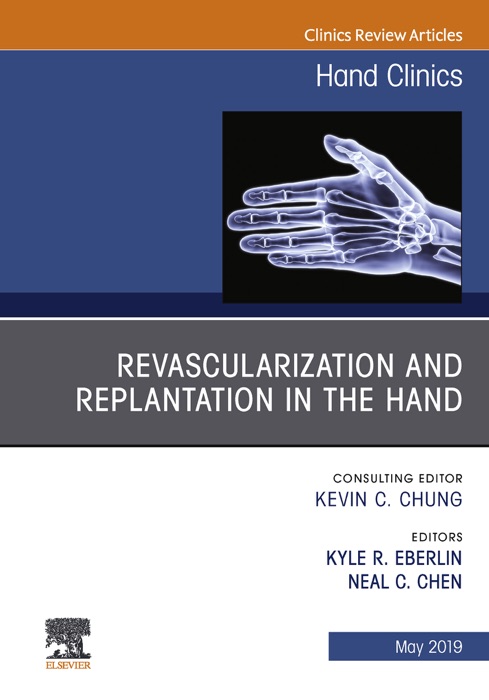 Revascularization and Replantation in the Hand, An Issue of Hand Clinics, Ebook