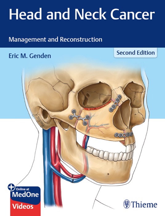 Head and Neck Cancer