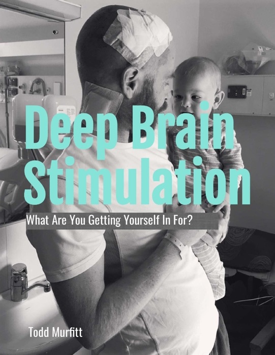 Deep Brain Stimulation