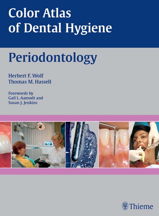 Color Atlas of Dental Hygiene: Periodontology