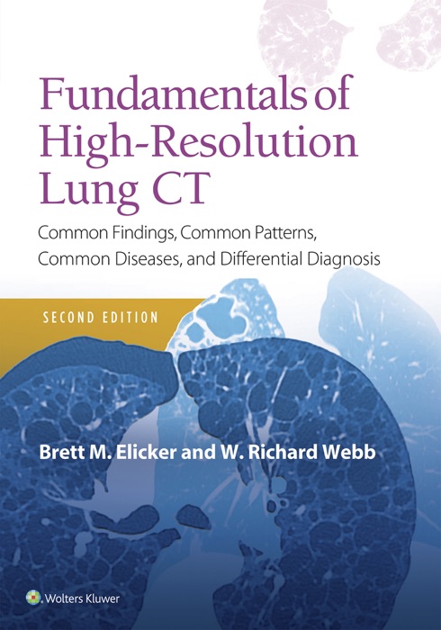 Fundamentals of High-Resolution Lung CT