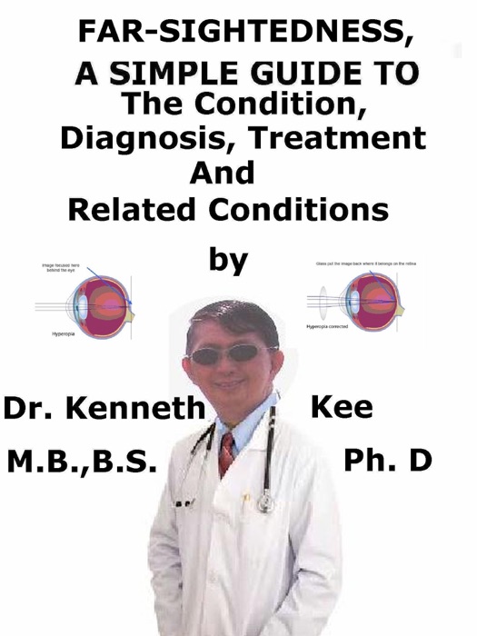 Far-Sightedness, A Simple Guide To The Condition, Diagnosis, Treatment And Related Conditions