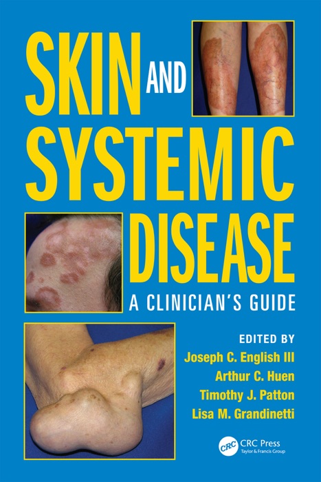 Skin and Systemic Disease