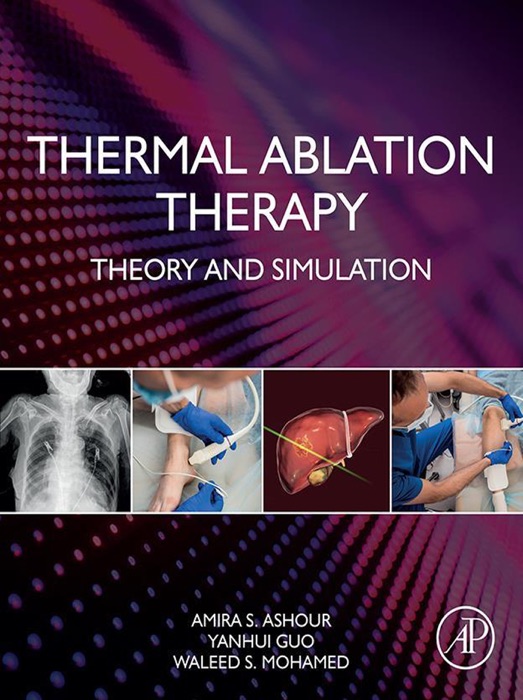 Thermal Ablation Therapy (Enhanced Edition)