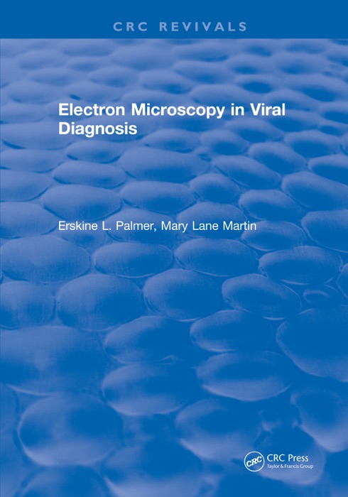 Electron Microscopy in Viral Diagnosis