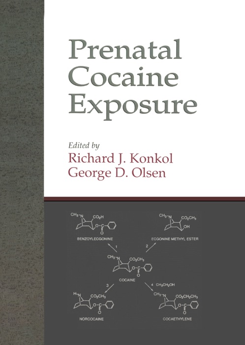 Prenatal Cocaine Exposure